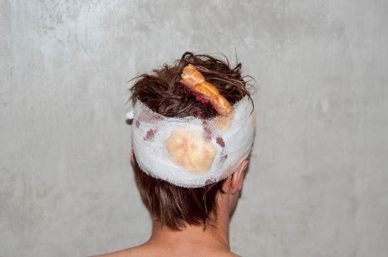 (фото) Силовики жестоко избили брата биатлонистки Домрачевой в Минске 