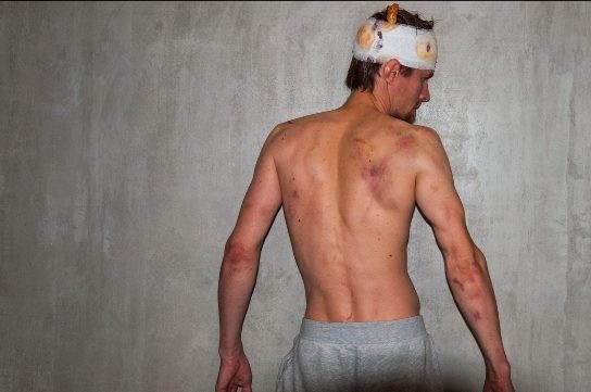 (фото) Силовики жестоко избили брата биатлонистки Домрачевой в Минске 