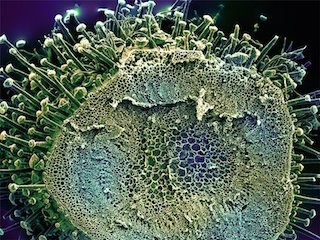 В Самарской области от ковида умер молодой мужчина В Самарской области от ковида умер молодой мужчина