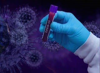 В Самарской области разрабатывают аппарат для удаленной диагностики ковида В Самарской области разрабатывают аппарат для удаленной диагностики ковида